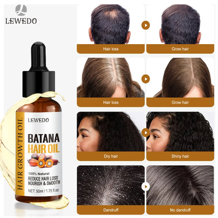 Hair Growth Batana Oil Serum Fast Growing Hair Essential Oil Beauty Hair Care Anti-Hair Loss Essence Natural Repair Damaged Hair