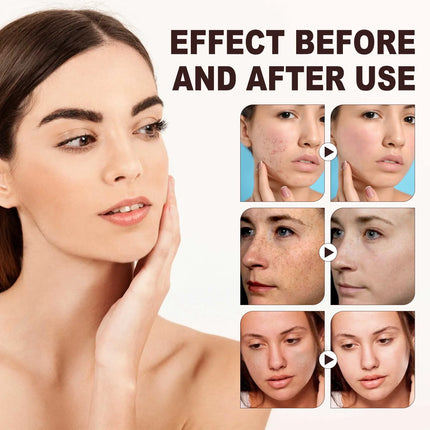 Coffee Scrub for Face Body Exfoliating Brightening Cleaning Dark Spots Removal Fade Melanin Pigmentation Whitening Scrub Cream-KarWorkwear