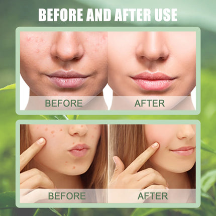 Green Tea Mask Face Clean GreenTea Mask Stick Deep Moisturizing Shrink Pores Blackhead Acne Facial Film Korean Skin Care Product-KarWorkwear